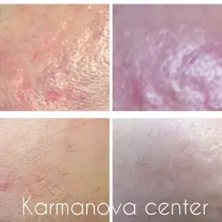 Неллі Карманова