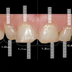 Dental wakacje