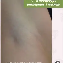 Лариса Зубкова