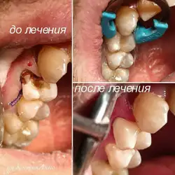 Анна Костюк — Миколаїв