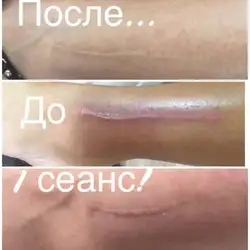 Олена Ростовщікова