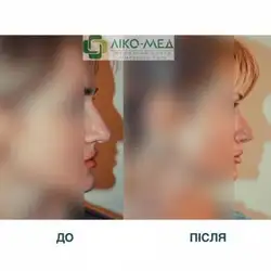Медичний центр Ліко-Мед - Миколи Ушакова — Київ