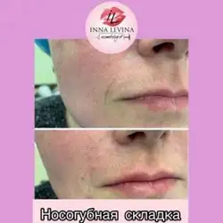 Інна Левіна - косметолог — Київ