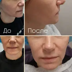 Любовь Горенок Косметолог
