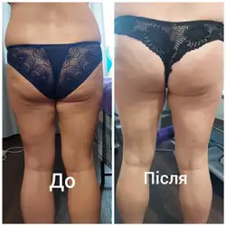 Олена Тарасова Масажист
