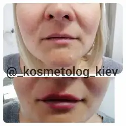 Яна Юренкова — Київ