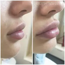 Сулакова Карина — Запоріжжя