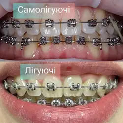 Прокопчук Ольга — Полтава