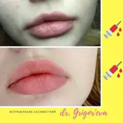 Олена Григор'єва — Харків