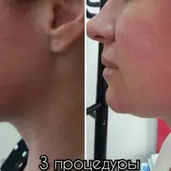 Юлія Лепендина