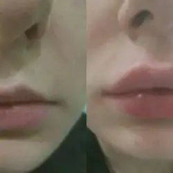 Наталі Молодецка — Одеса