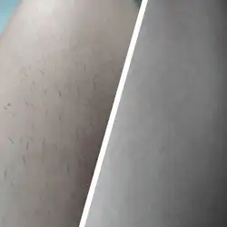 Шугаринг