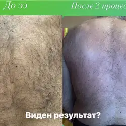 Ірина Жукова майстер епіляції