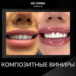 Вероніка Григоріадис — Одеса