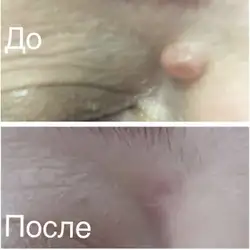 Людмила Морозова