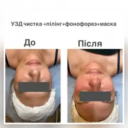 Ірина Суботіна
