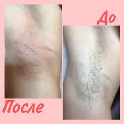 Юлія Бондар майстер епіляції — Харків
