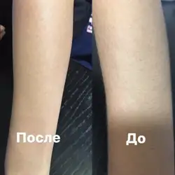 Шугаринг Віск