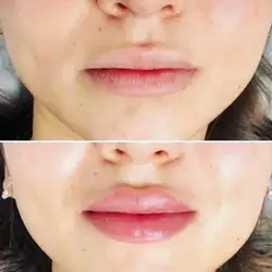 Вікторія Давиденко — Київ