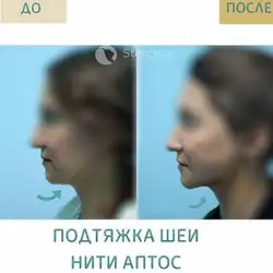 Марина Старцева Косметолог — Київ