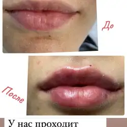 Наталія Татарчук
