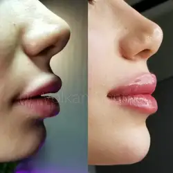 Dr Volkan Sonmez Aesthetic
