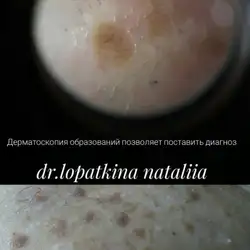 Наталія Лопаткіна