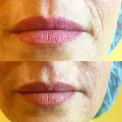 Анна — Харків