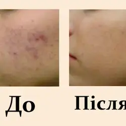 Олена Макаревич Косметолог