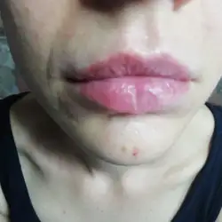 Оксана Мисюра