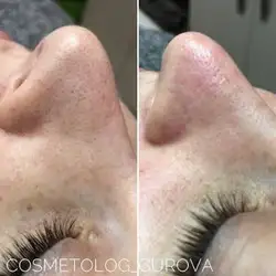 Олена Гурова — Одеса