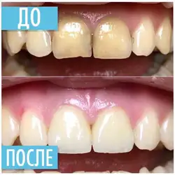 Владислав Іцкович — Дніпро
