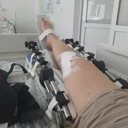 ОБЛАСНИЙ ЦЕНТР РЕАБІЛІТАЦІЇ ДІТЕЙ З ОРГАНІЧНИМИ УРАЖЕННЯМИ НЕРВОВОЇ СИСТЕМИ