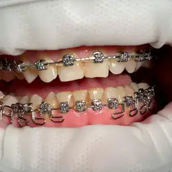 Loa Love Dental — Суми