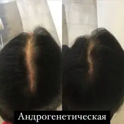 Валерій Мовчан — Київ