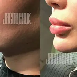 Андрій Якобчук - косметолог — Київ