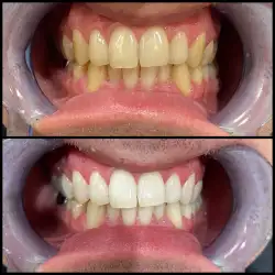 Студія Smile Bar - Дніпро, Антоновича — Дніпро