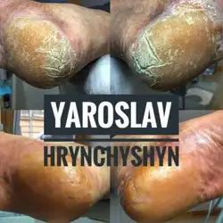 Грінчишин Ярослав