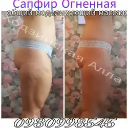 Алла Ходзинская — Одеса
